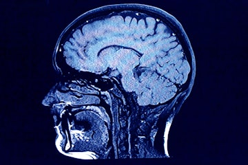Brain scan.