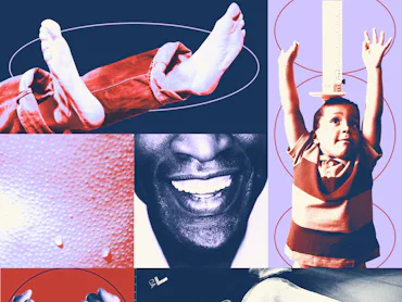 Collage of teeth, a child standing tall, feet, and sweating skin.