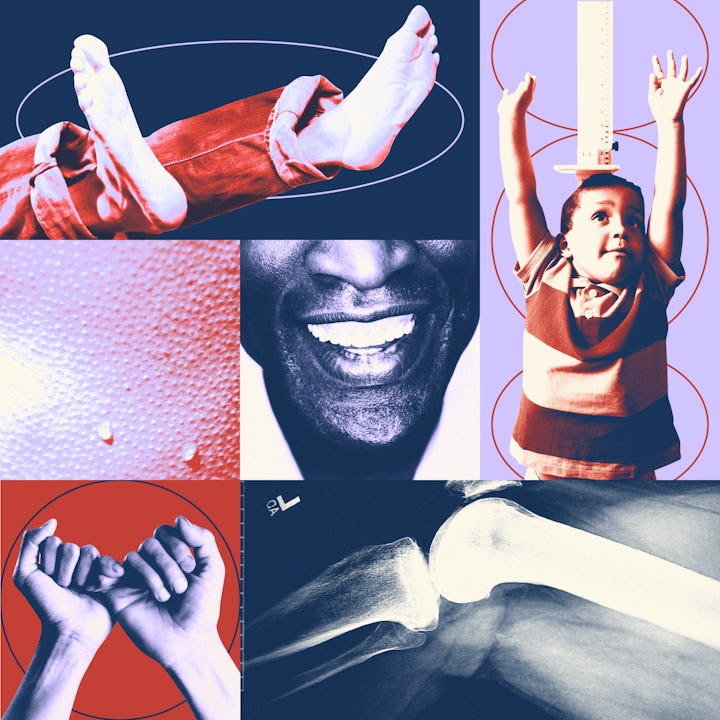 Collage of teeth, a child standing tall, feet, and sweating skin.