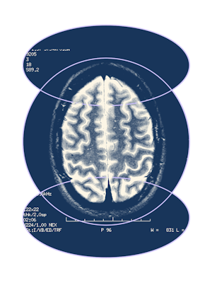 A human brain.