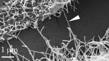 Black and white photo of hair-like filaments on the surface of a fungus, with 1 micrometer scale.