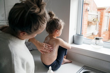 一位母亲把奶油涂在患水痘的孩子的背上，因为他们面对着窗户。