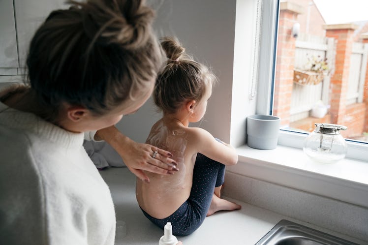 A mother applies cream to the back of her child who has chickenpox as they face a window.