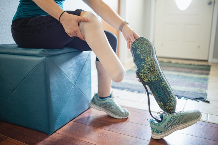woman with an amputated leg applies her prosthesis