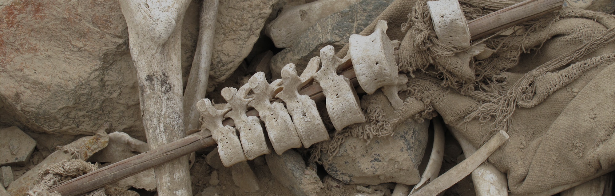Human vertebrae stacked on a post.