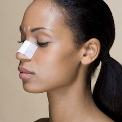 woman with a nose job bandage