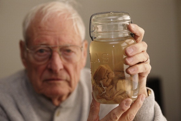 pathologist Thomas Harvey holding the brain of theoretical physicist Albert Einstein in a jar 