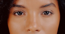 eyelid lift surgery woman eyes close up