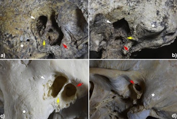 More detailed images of the skulls’ ear canals and the marks of surgery.