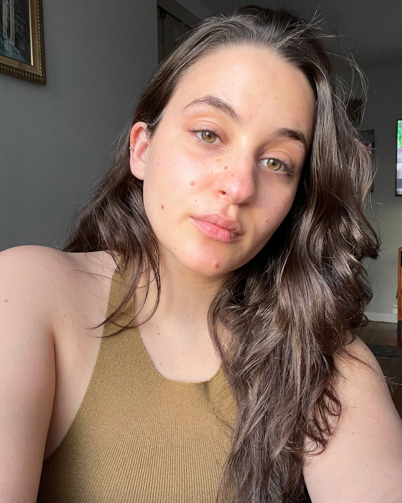 Isabella's skin after using the Georgia Louis x Toast Your Grace Bi-Phase Serum for three weeks. 