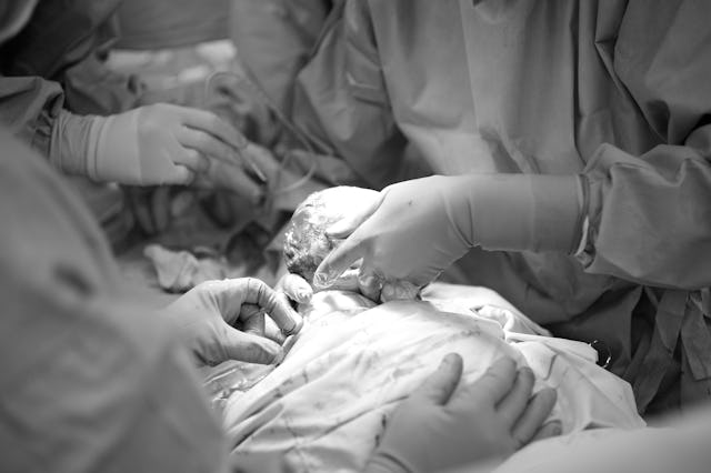 Doctors performing a C-section