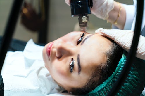 radiofrequency face treatment