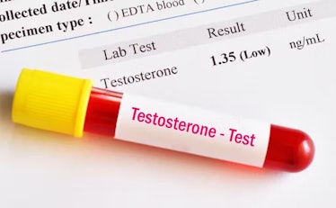 Psychological problems can cause a drop in testosterone.