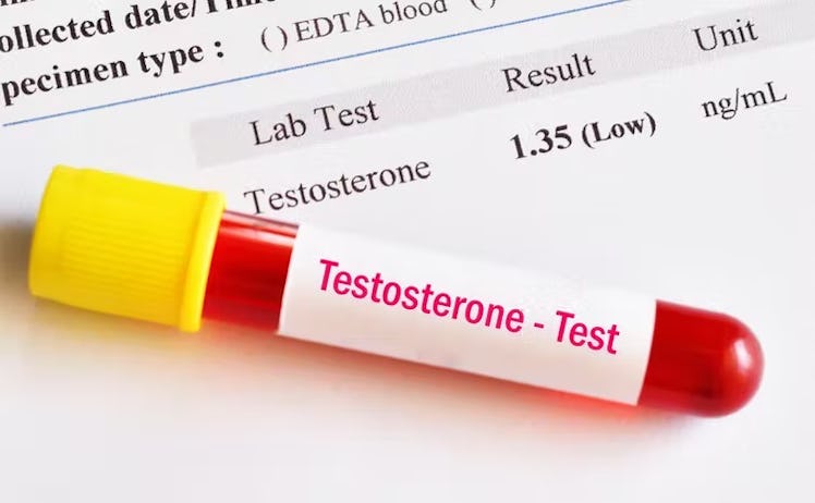 Psychological problems can cause a drop in testosterone.