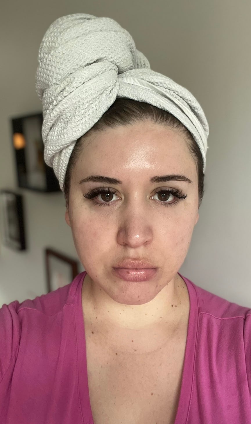 NuFACE before and after after photo