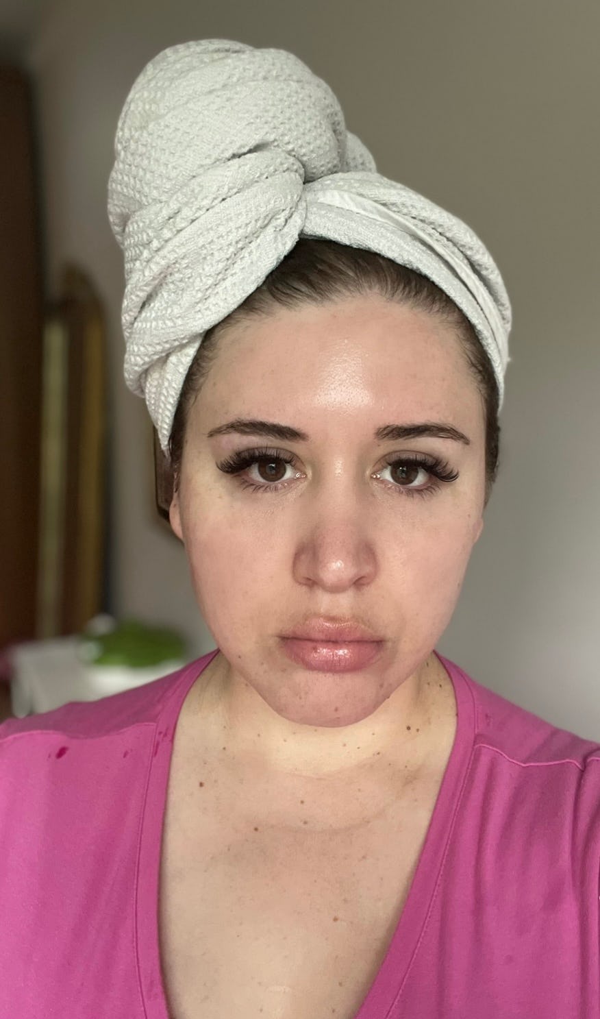 NuFACE before and after photo