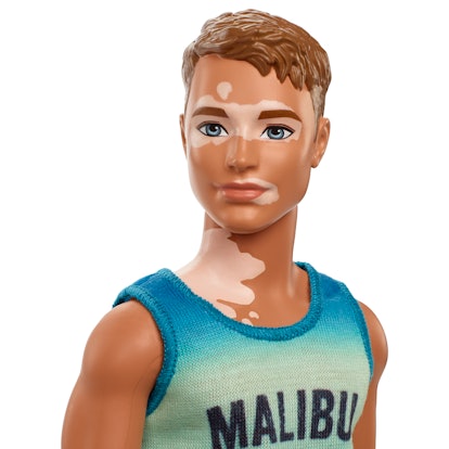 A Ken doll with vitiligo will be available in June.