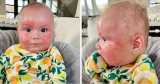 A brave mom shares on TikTok what happens to her baby when she can't access the right type of formul...