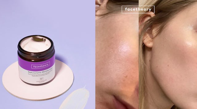 A retinol alternative Bakuluronic Moisturiser M1 product on the left, and a skin transformation on t...