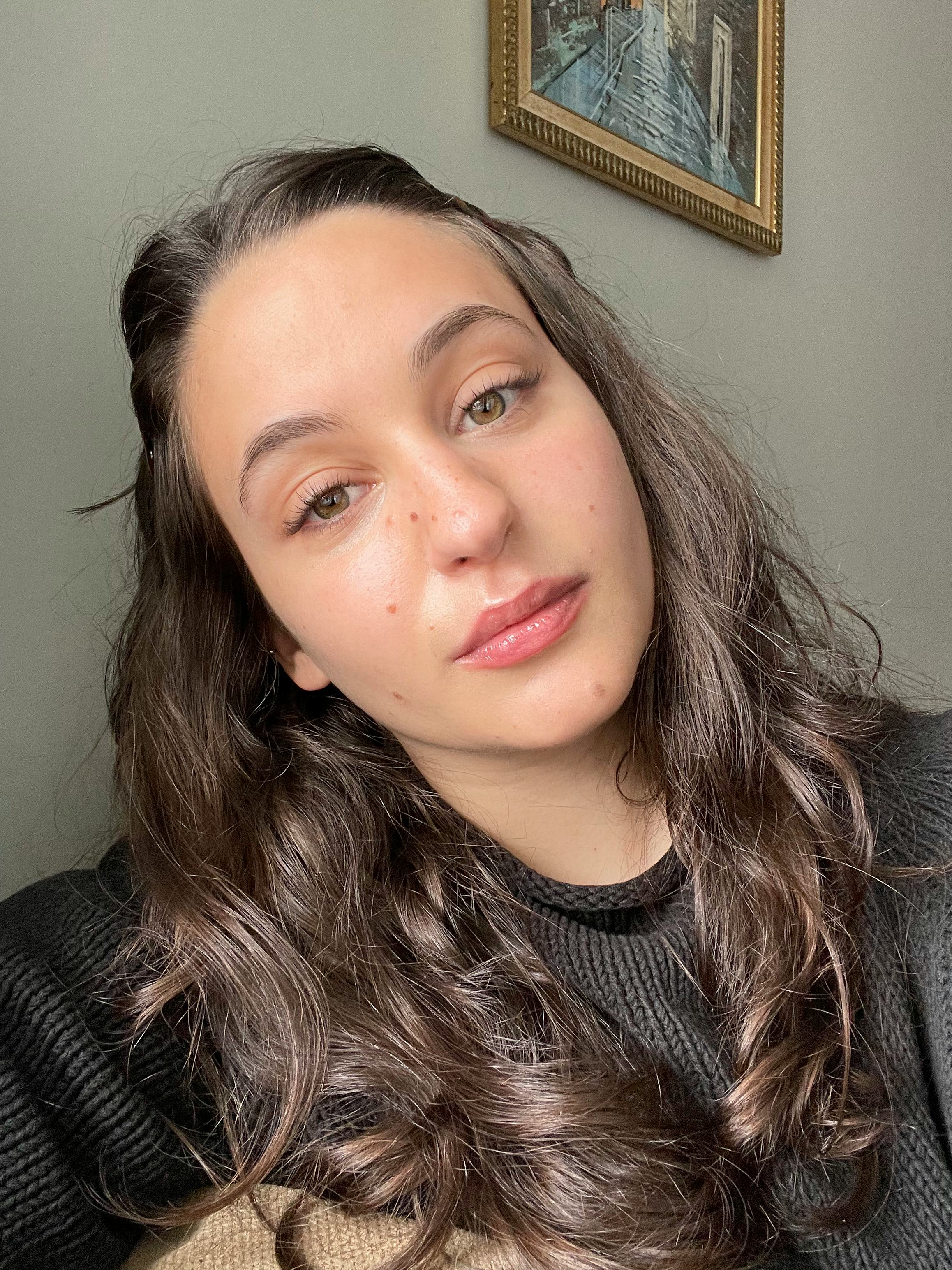 isabella after using the ordinary serum for four weeks