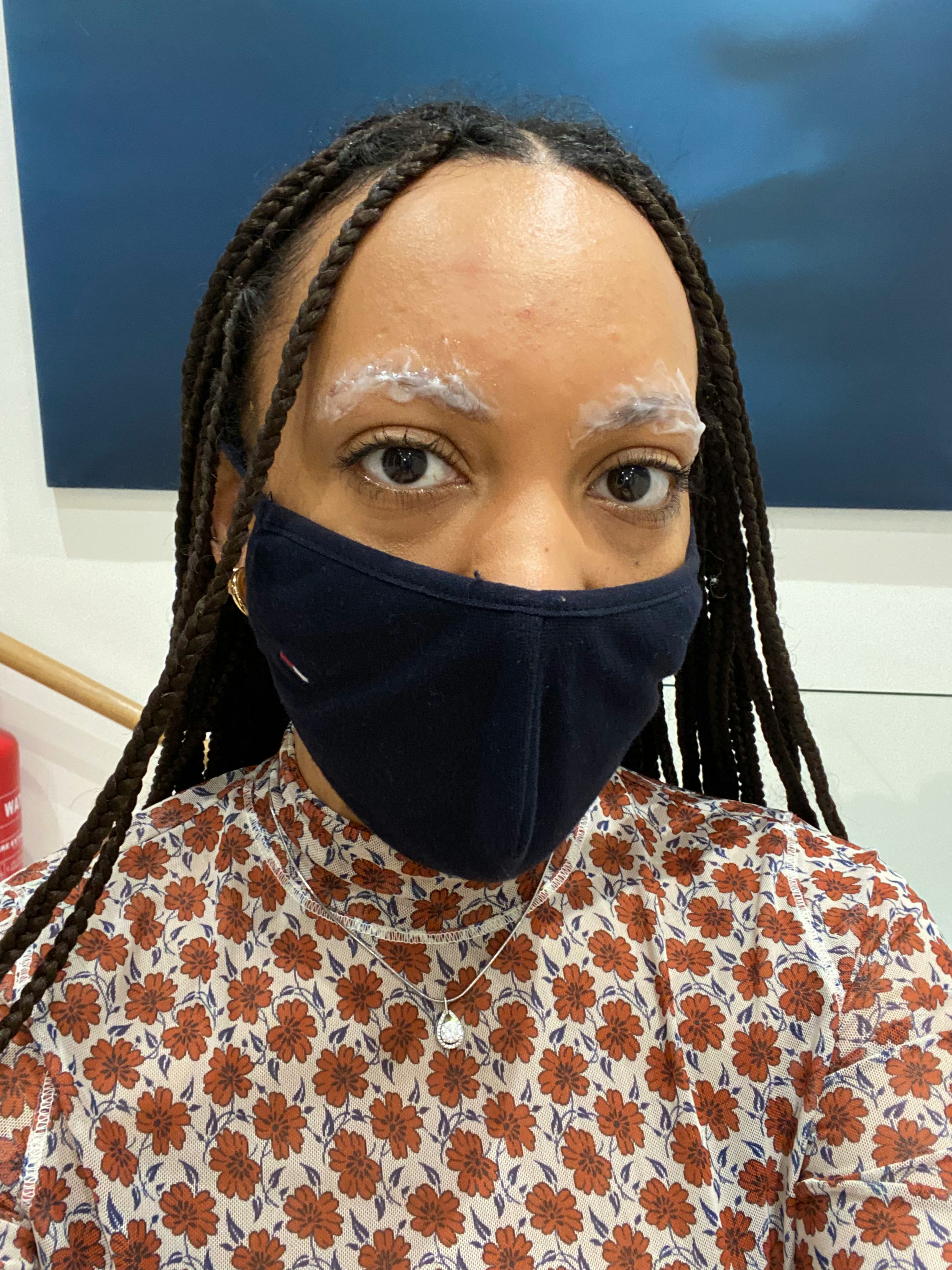 Jessica Morgan preparing for her microblading treatment with numbing cream