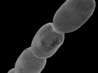 A microscopic image if the biggest bacteria ever