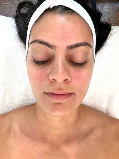 I Tried The 300 Diamondglow Facial — Here S My Honest Review