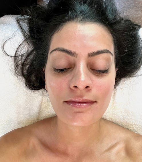 michelle rostamian post diamondglow facial