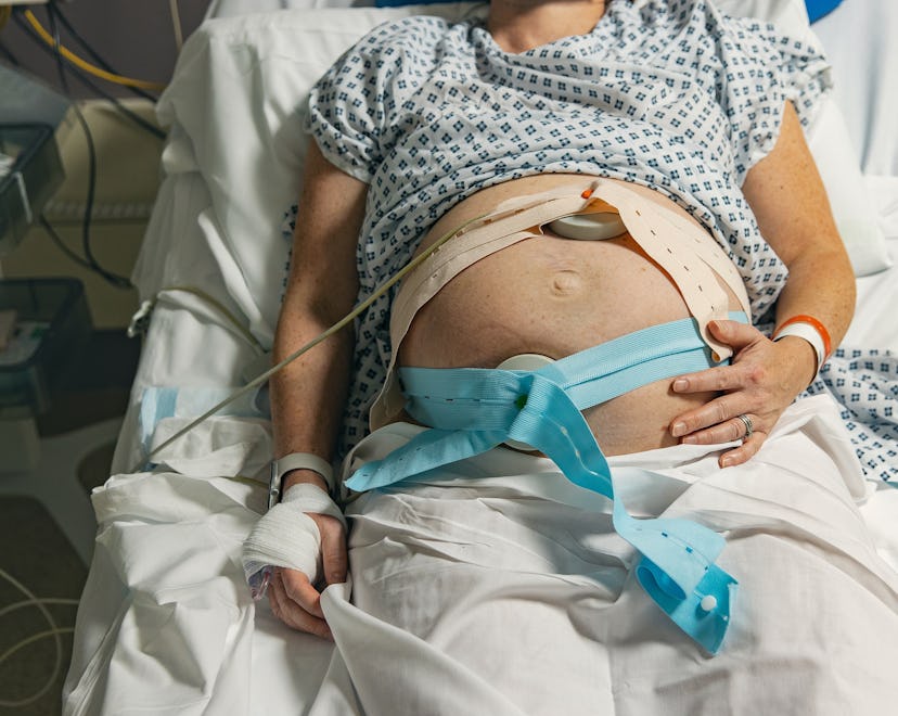 what is pitocin induction? woman in labor strapped to heart monitor 