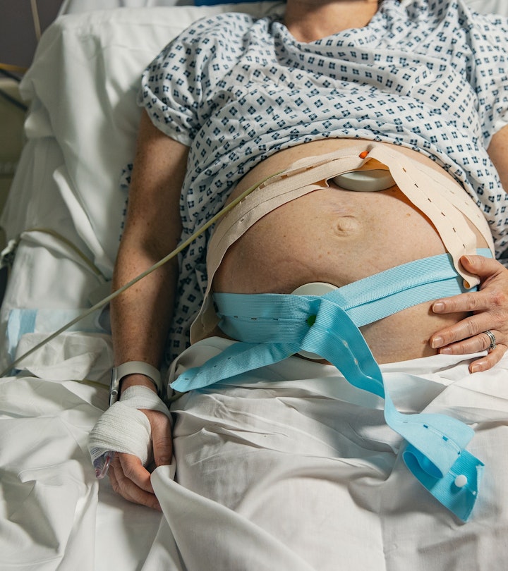 what is pitocin induction? woman in labor strapped to heart monitor 