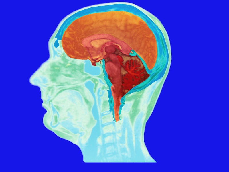 brain