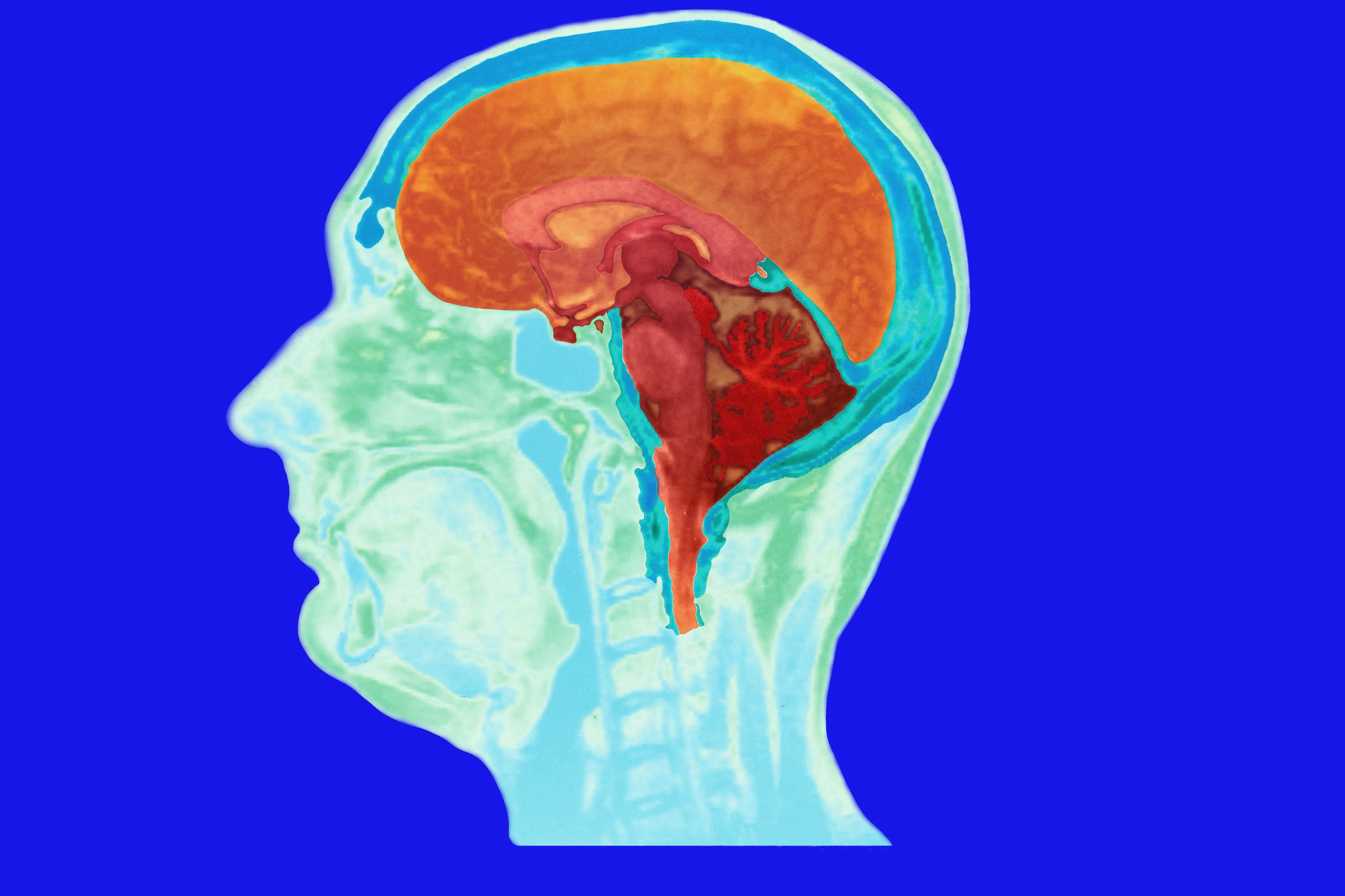 What are the physical signs of anxiety? Why your body's cues may throw ...