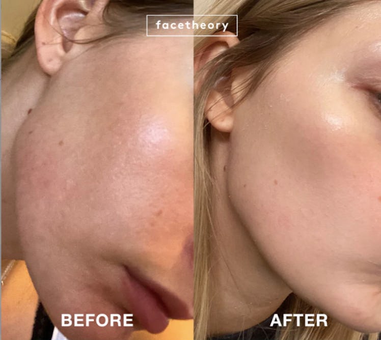 facetheory retinol alternatives