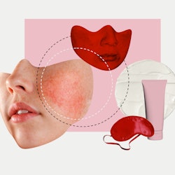 A collage with woman's face struggling with rosacea, a pink cream product, and geometric shapes