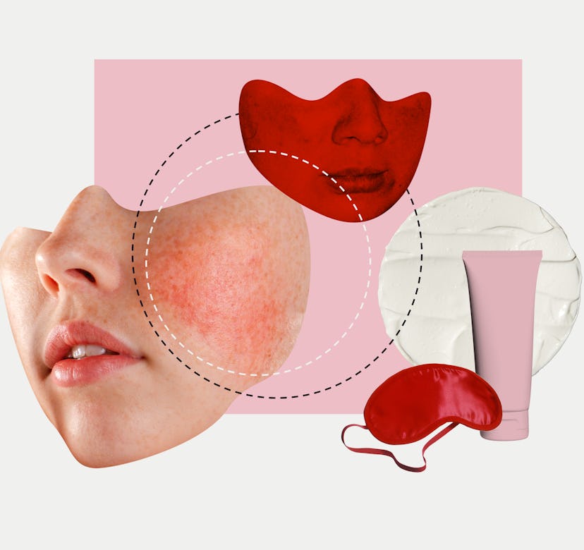 A collage with woman's face struggling with rosacea, a pink cream product, and geometric shapes