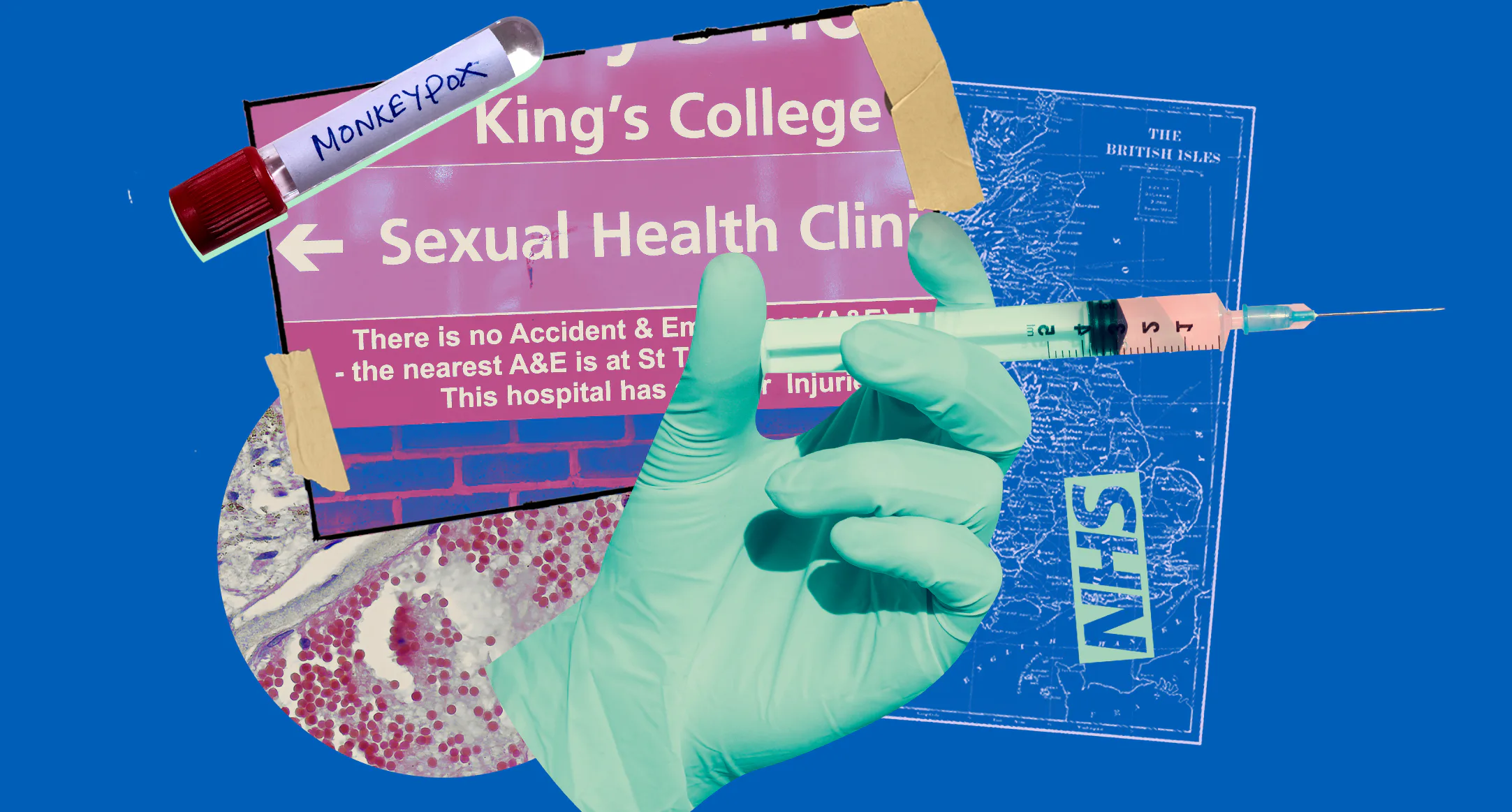 How To Get A Monkeypox Vaccine In The UK