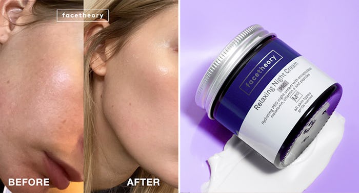 A woman's skin before and after using Potent & Budget-Friendly Alternatives to retinol