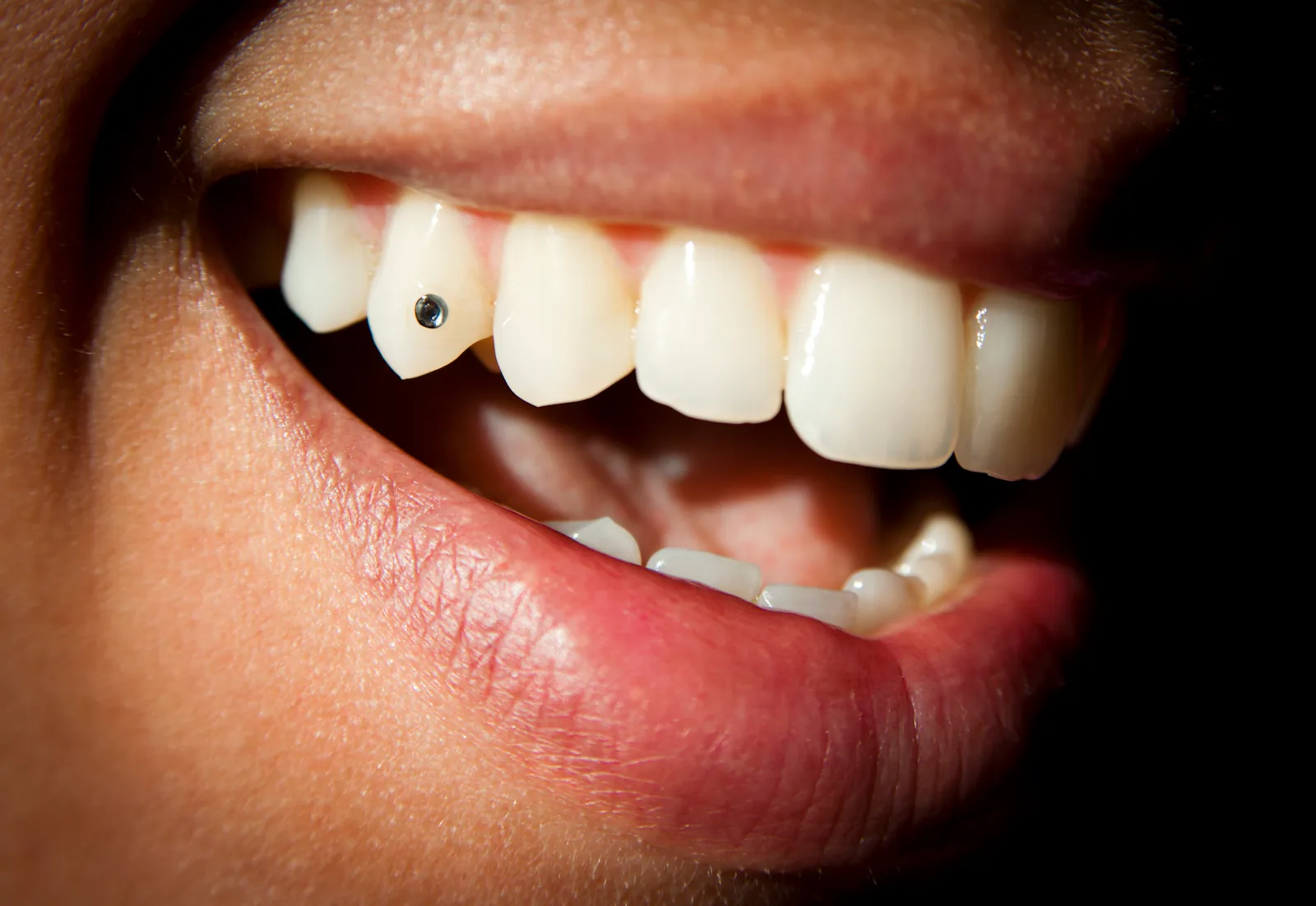 Bussel Teeth Where To Get A Tooth Gem Applied In The UK