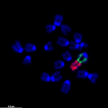 An image of the chromosomes tweaked by Li-Bin Wang and colleagues.