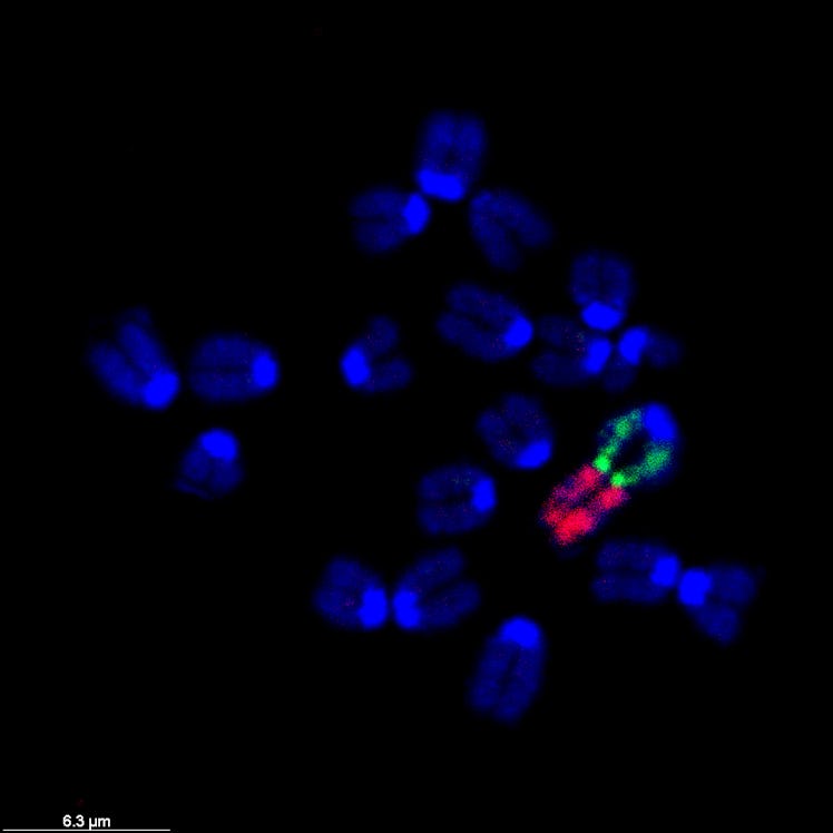 An image of the chromosomes tweaked by Li-Bin Wang and colleagues.