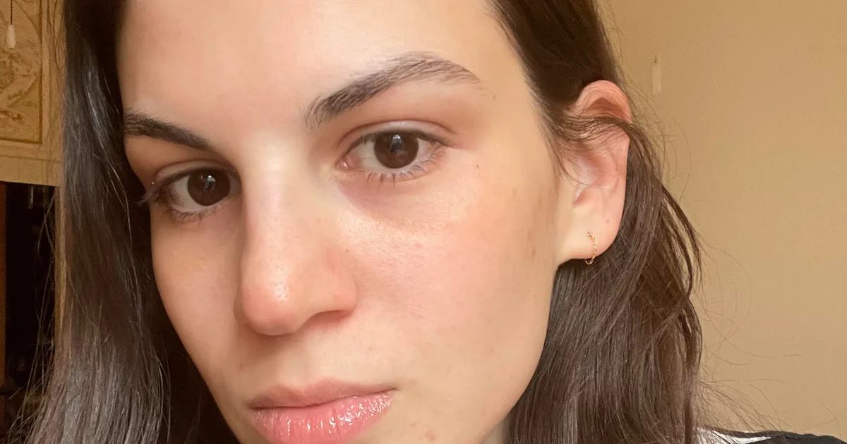 My Hormonal Acne Skin Care Routine Keeps Breakouts At Bay My Hormonal Acne Skin Care Routine Keeps Breakouts At Bay