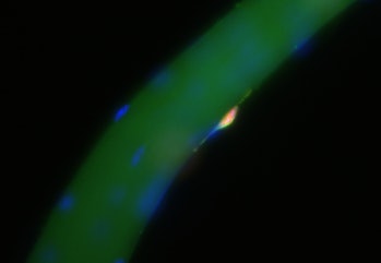 A green thread of muscle fiber sparsely covered with stem cells. 