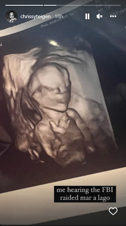 Chrissy Teigen shared her baby's ultrasound photo.