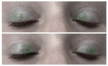 a comparison of the same set of eyes demonstrating REM sleep
