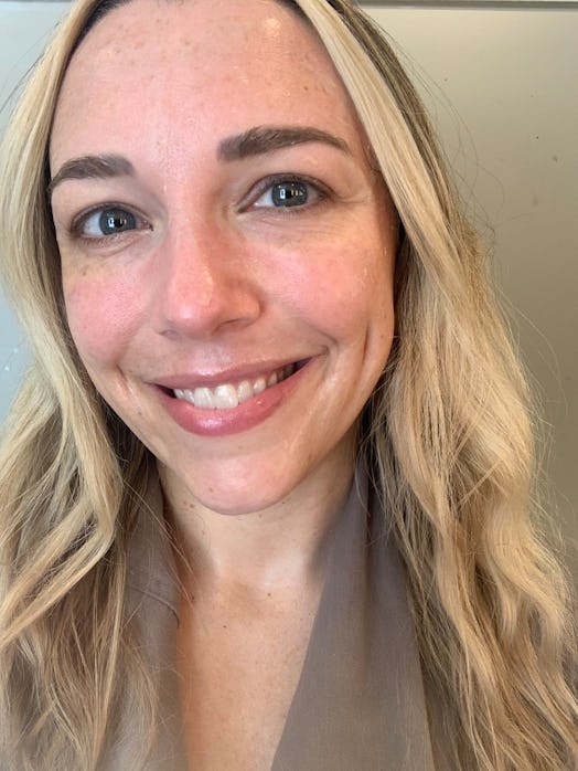 Results of a HydraFacial.