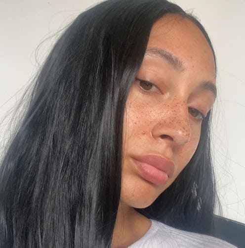Does ice help with acne? Here's what derms say.