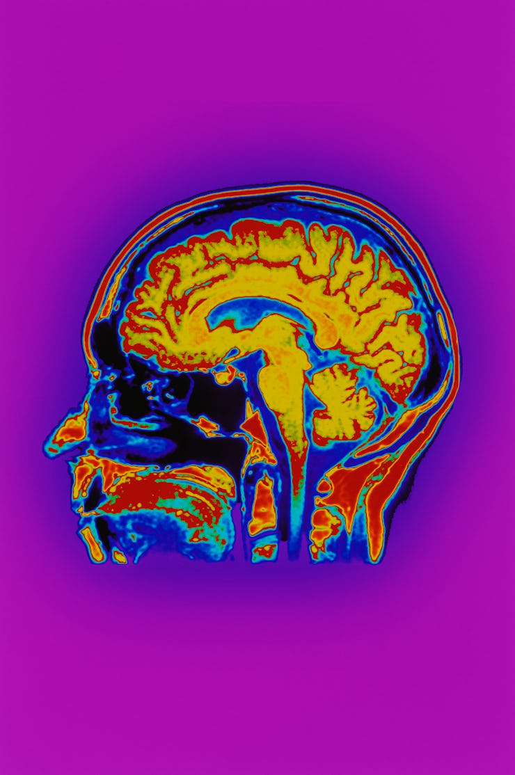 Cat scan of human head