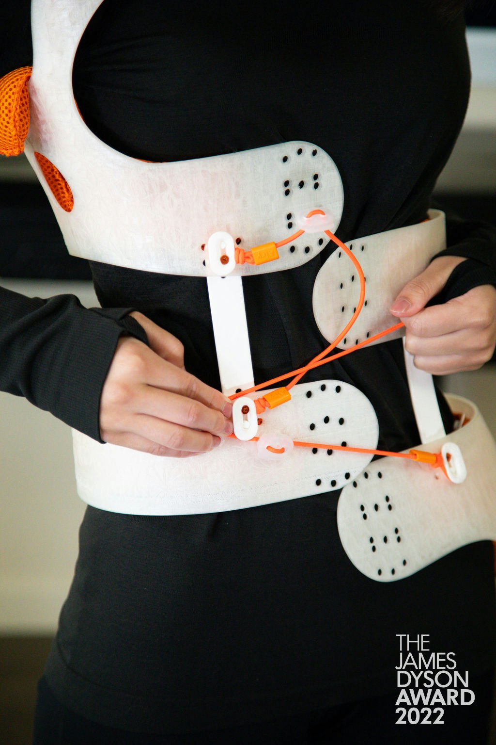 This innovative scoliosis brace 'grows' with its wearer
