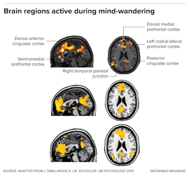 MRI scans showing regions activated while your mind wanders 