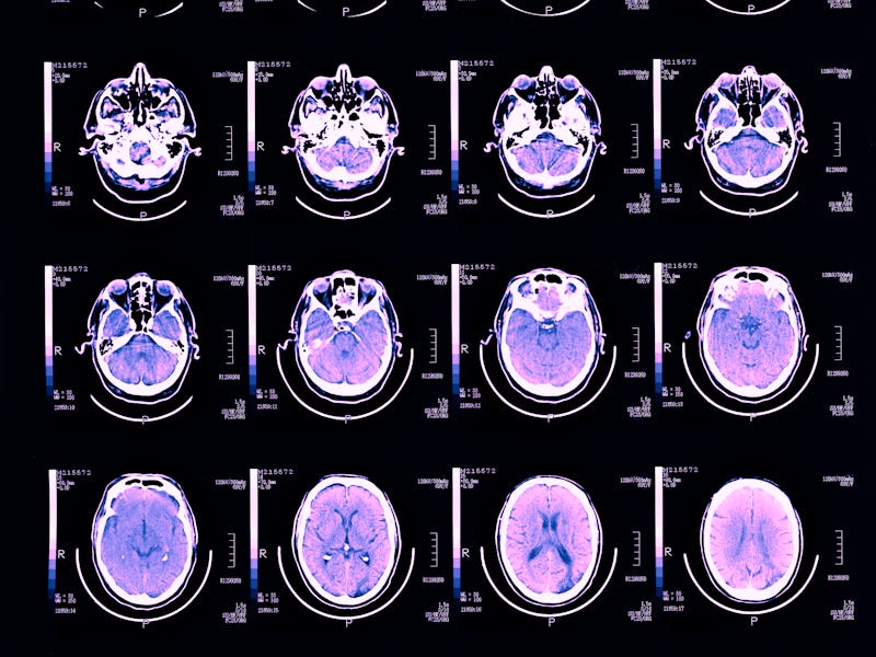 Brain scans